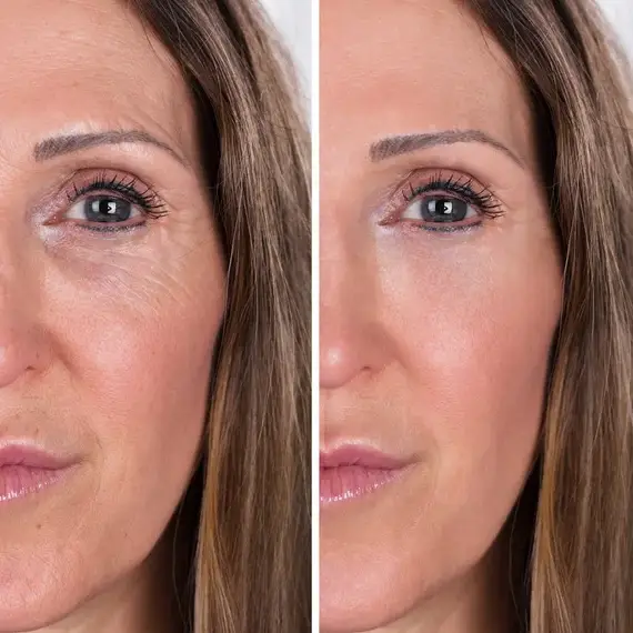 Before and After 10