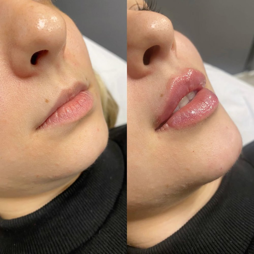 Before and After 11