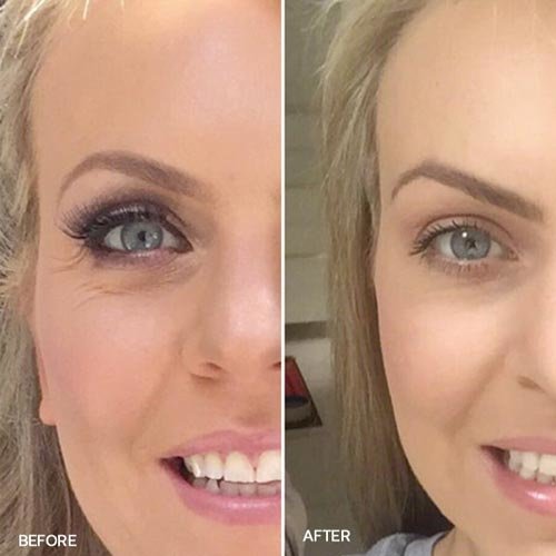 Before and After 2