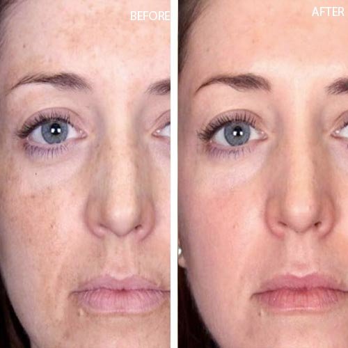 Before and After 3