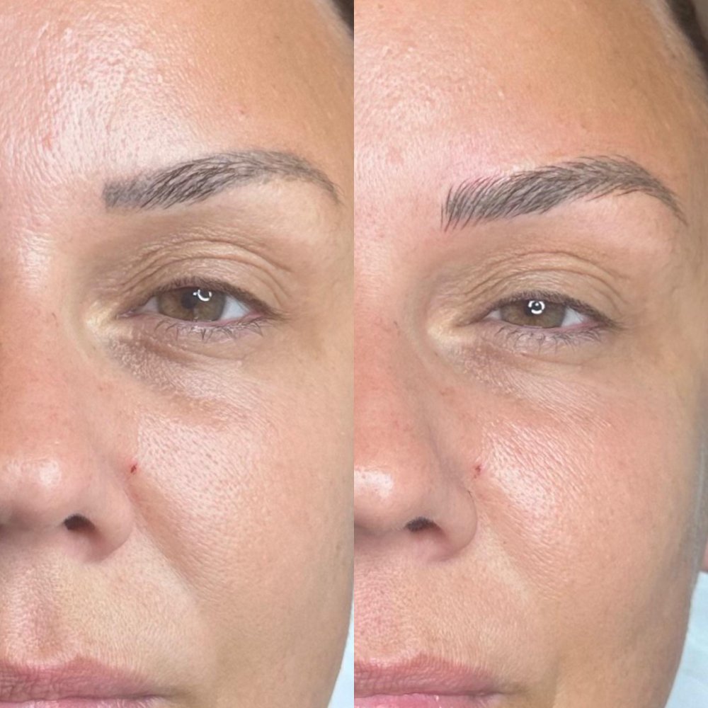 Before and After 4