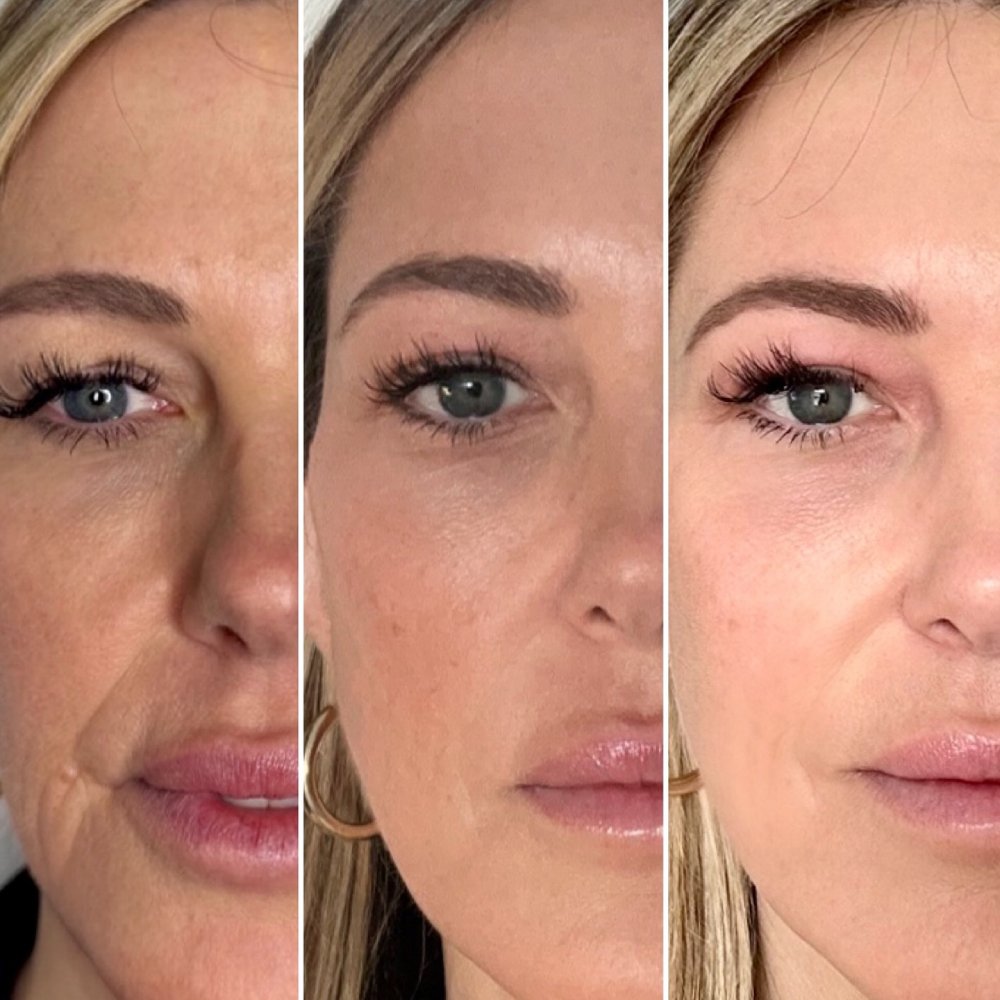 Before and After 5