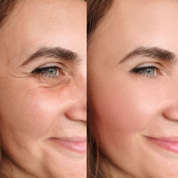 Before and After 8