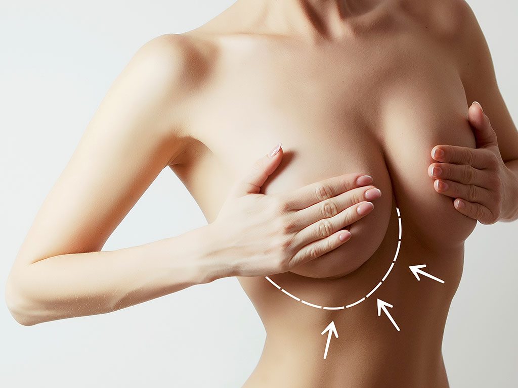 Breast Aesthetic Surgery in Turkey